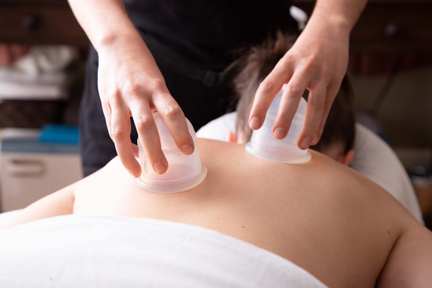 Muscle Rescue cupping